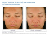 Glytone Enhance Brightening Complex 30ml