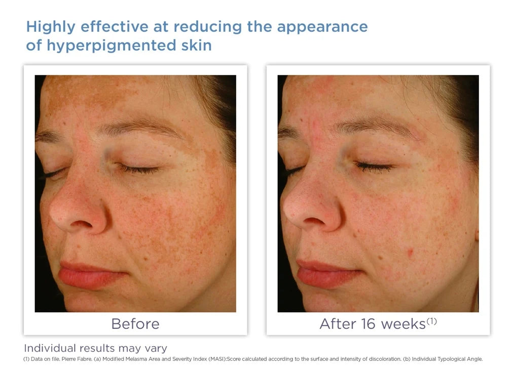 Glytone Enhance Brightening Complex 30ml