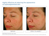 Glytone Enhance Brightening Complex 30ml