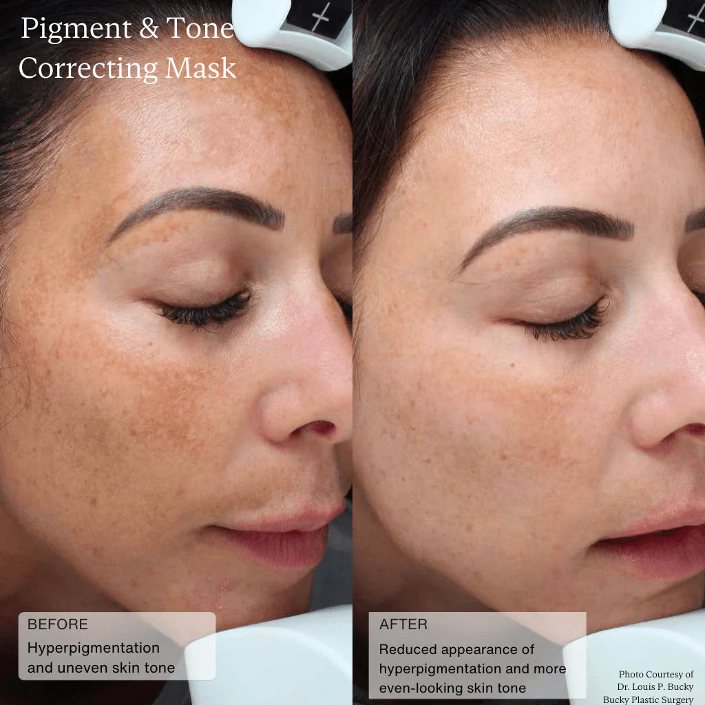 Cysteamine HSA Pigment & Tone Corrector - 50mls