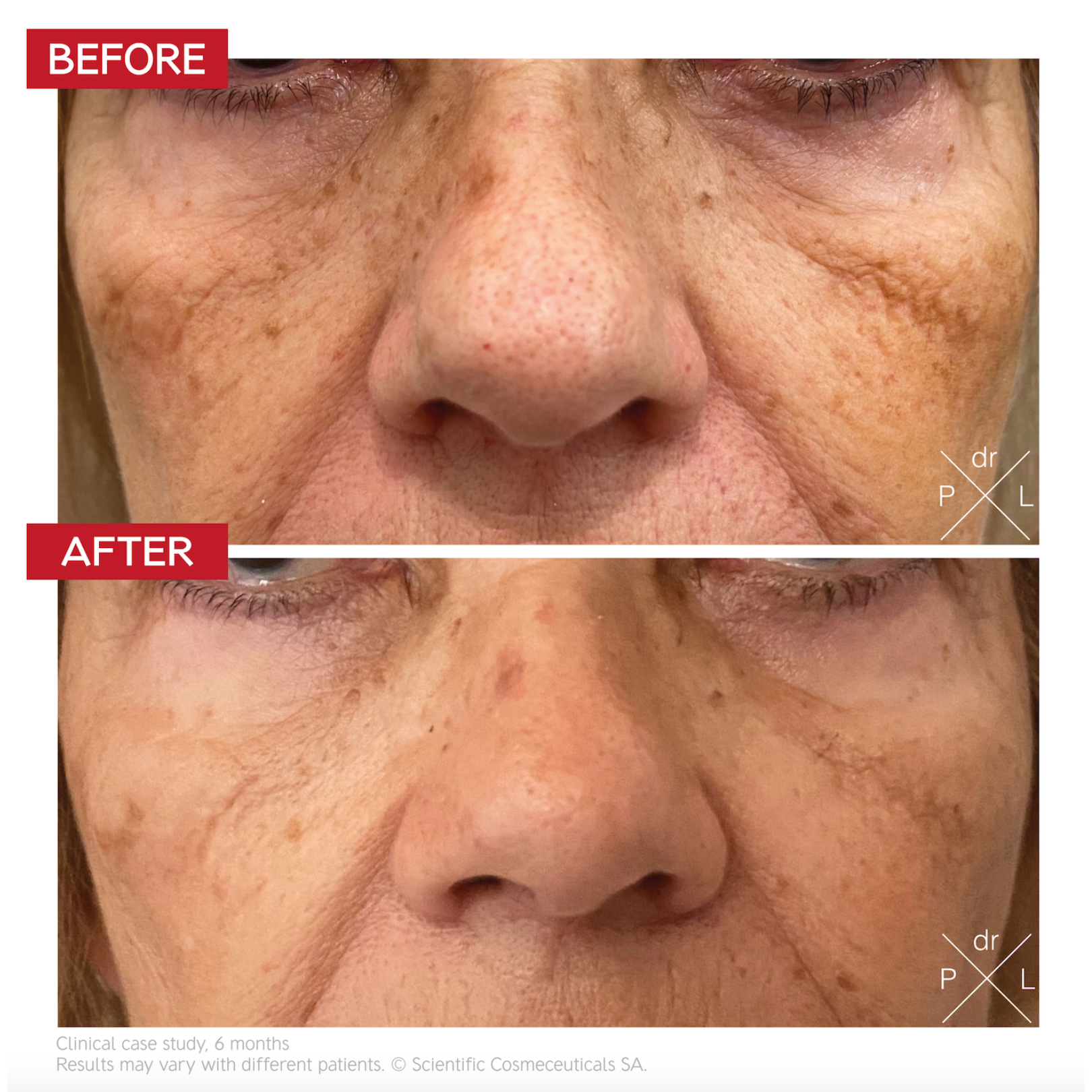 Dr LEVY Pigment Control Drops 30ml
