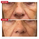 Dr LEVY Pigment Control Drops 30ml