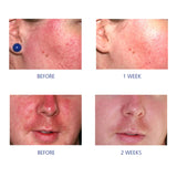 iS CLINICAL Pro-Heal Serum Advance+