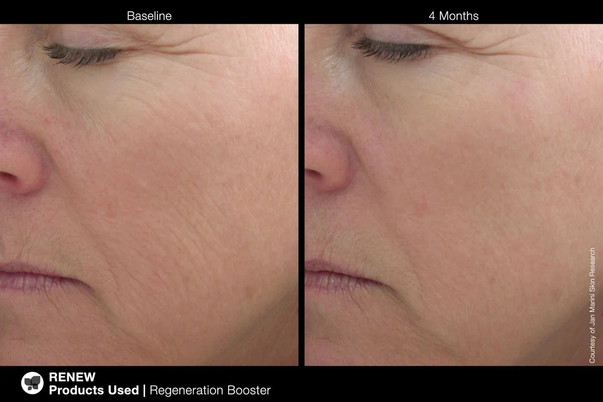 Jan Marini Regeneration Booster 30ml