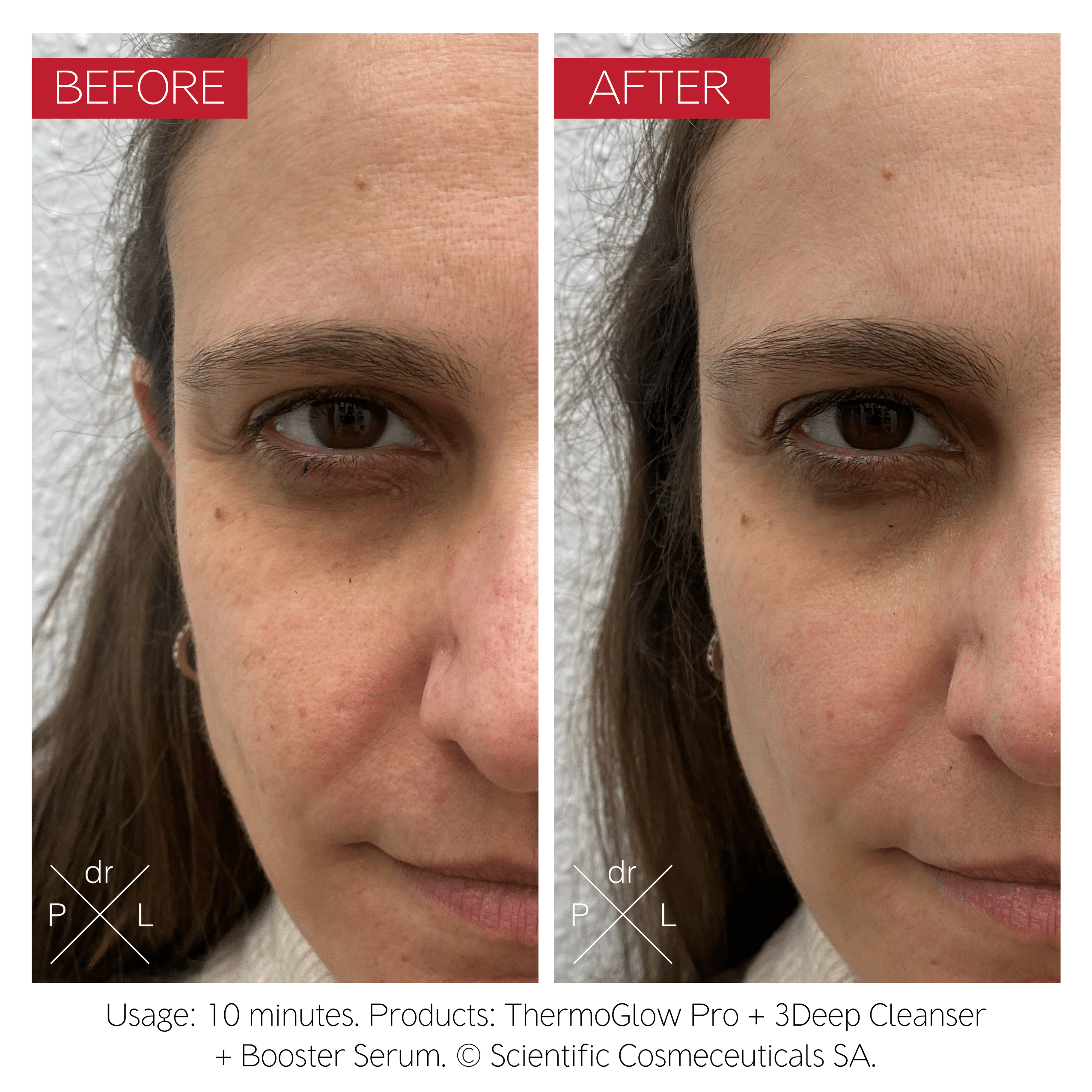 Dr LEVY ThermoGlow Pro