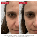 Dr LEVY ThermoGlow Pro