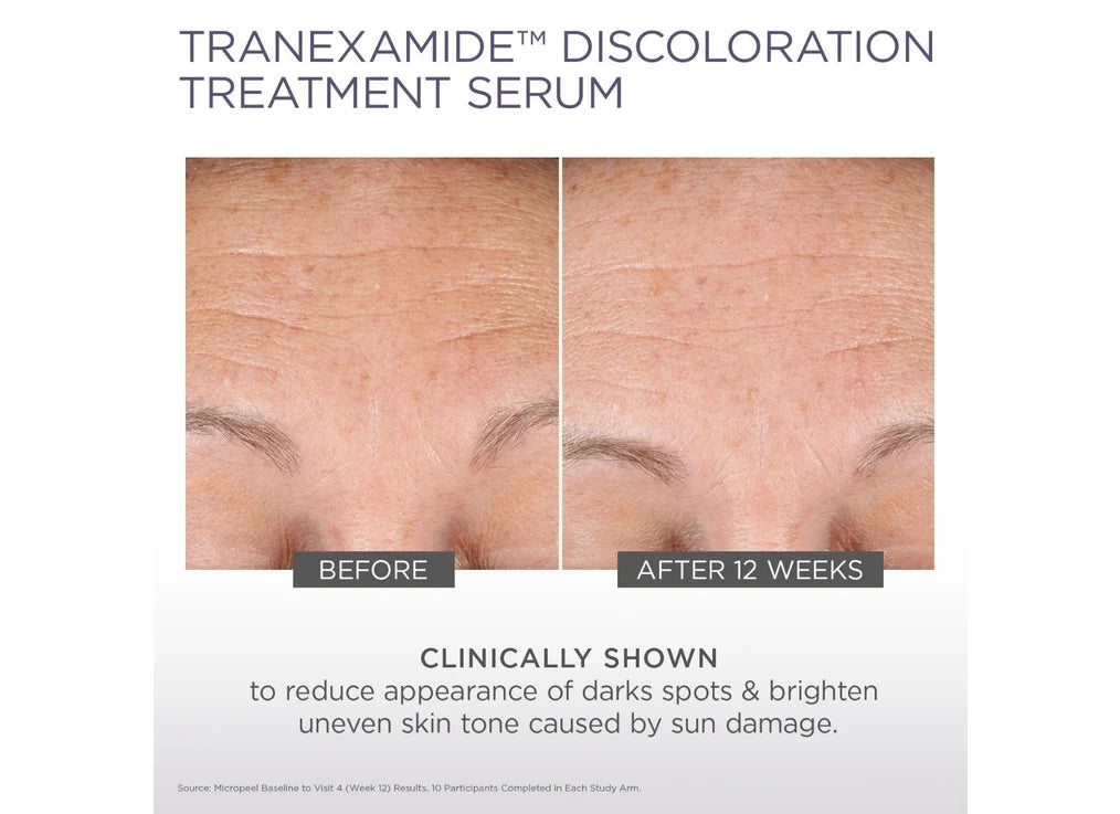 Glytone TranEXamide Discoloration Treatment Serum 30ml