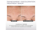 Glytone TranEXamide Discoloration Treatment Serum 30ml