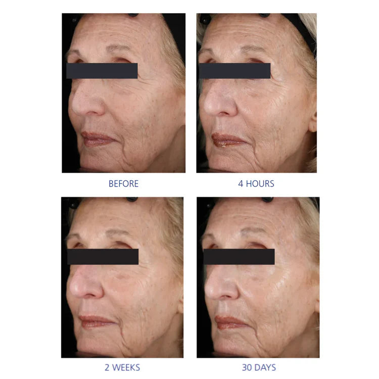 iS CLINICAL Youth Eye Complex